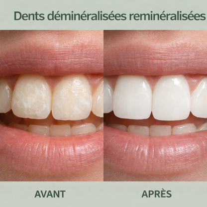 REMINORAL™ – Le geste simple qui renforce votre sourire