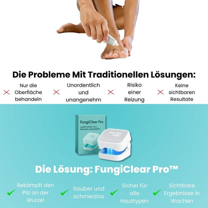 FungiClear Pro™ - Laser-Nagelpilz-Behandlung Gerät