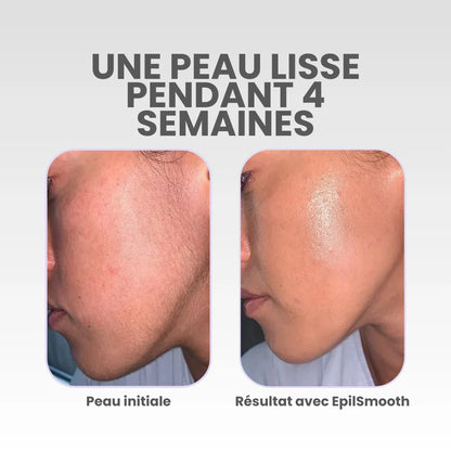 EpilSmooth⎪Épilateur visage