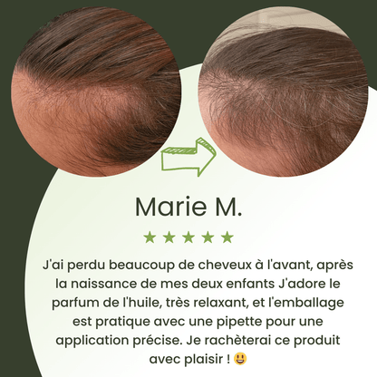 Huile de croissance pour cheveux