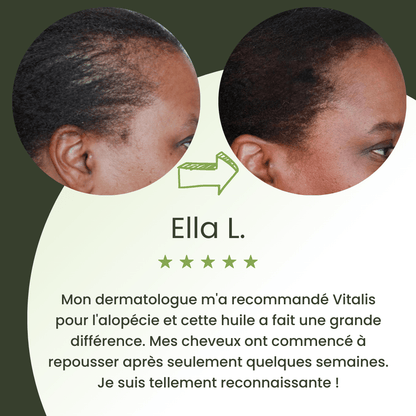 Huile de croissance pour cheveux