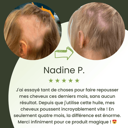 Huile de croissance pour cheveux