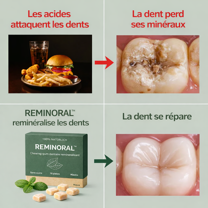 REMINORAL™ – Le geste simple qui renforce votre sourire